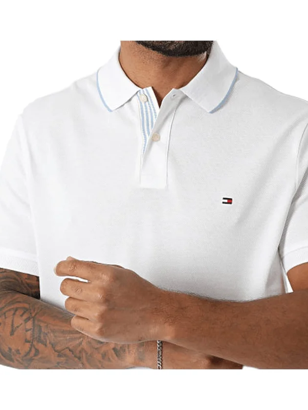 Seas Placket Intrest